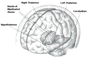 Left & Right THALAMUS with the "Y" pattern