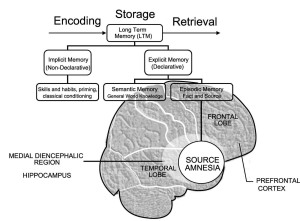 Brain Amnesia